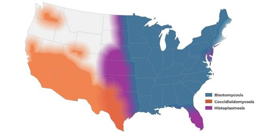 a map of the United States showing distribution of Blastomycosis, Coccidioidomycosis, and Histoplasmosis