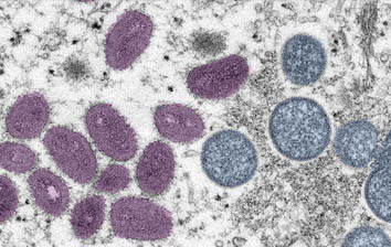 a microscopic view of the monkeypox virus